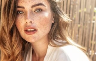 viralMd marketing Why Do I Have Freckles Microneedling For Age Spots _ Freckles.jpg