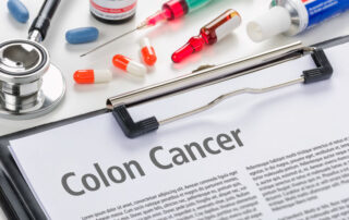 viralmd-marketing-Should-You-Get-A-Colonoscopy-In-Your-30s-3-Myths-About-Colorectal-Cancer
